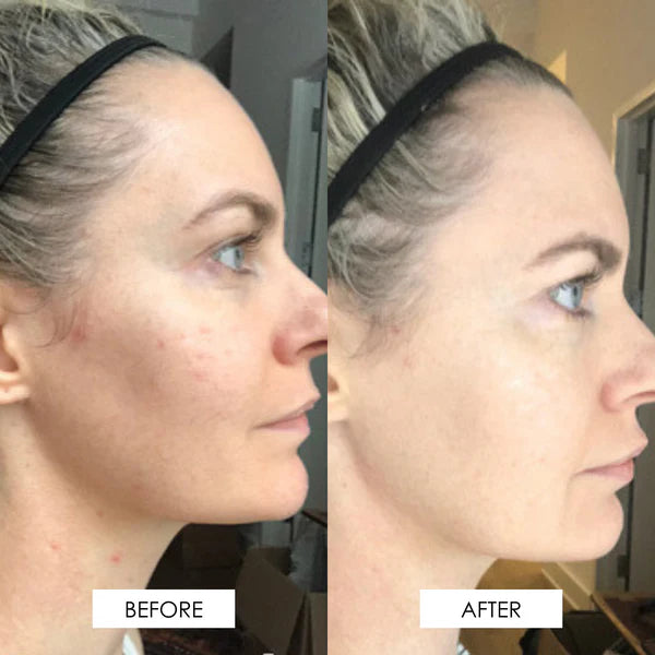 All-In-One Korean Anti-Aging Collagen Cream