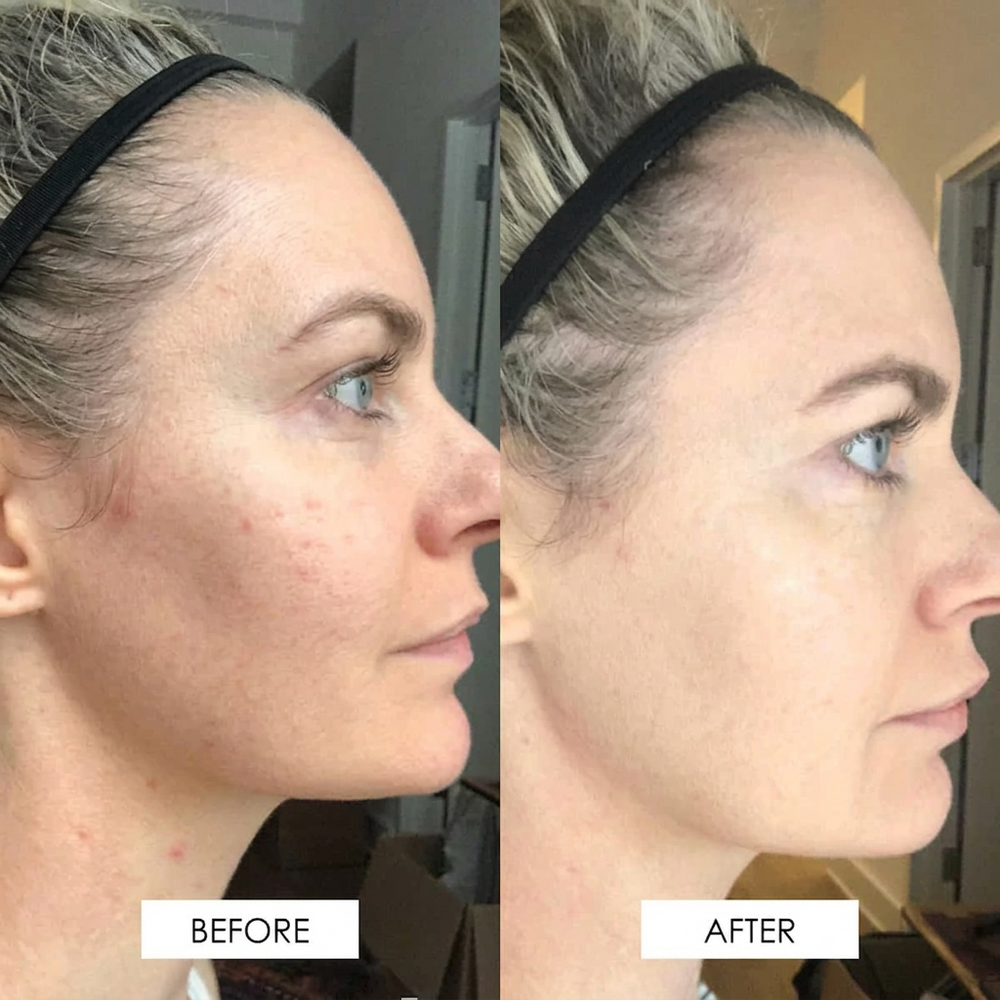 BBL Serum bottle